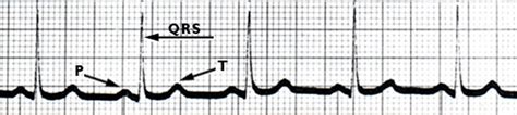 Quick Facts:Electrocardiography .